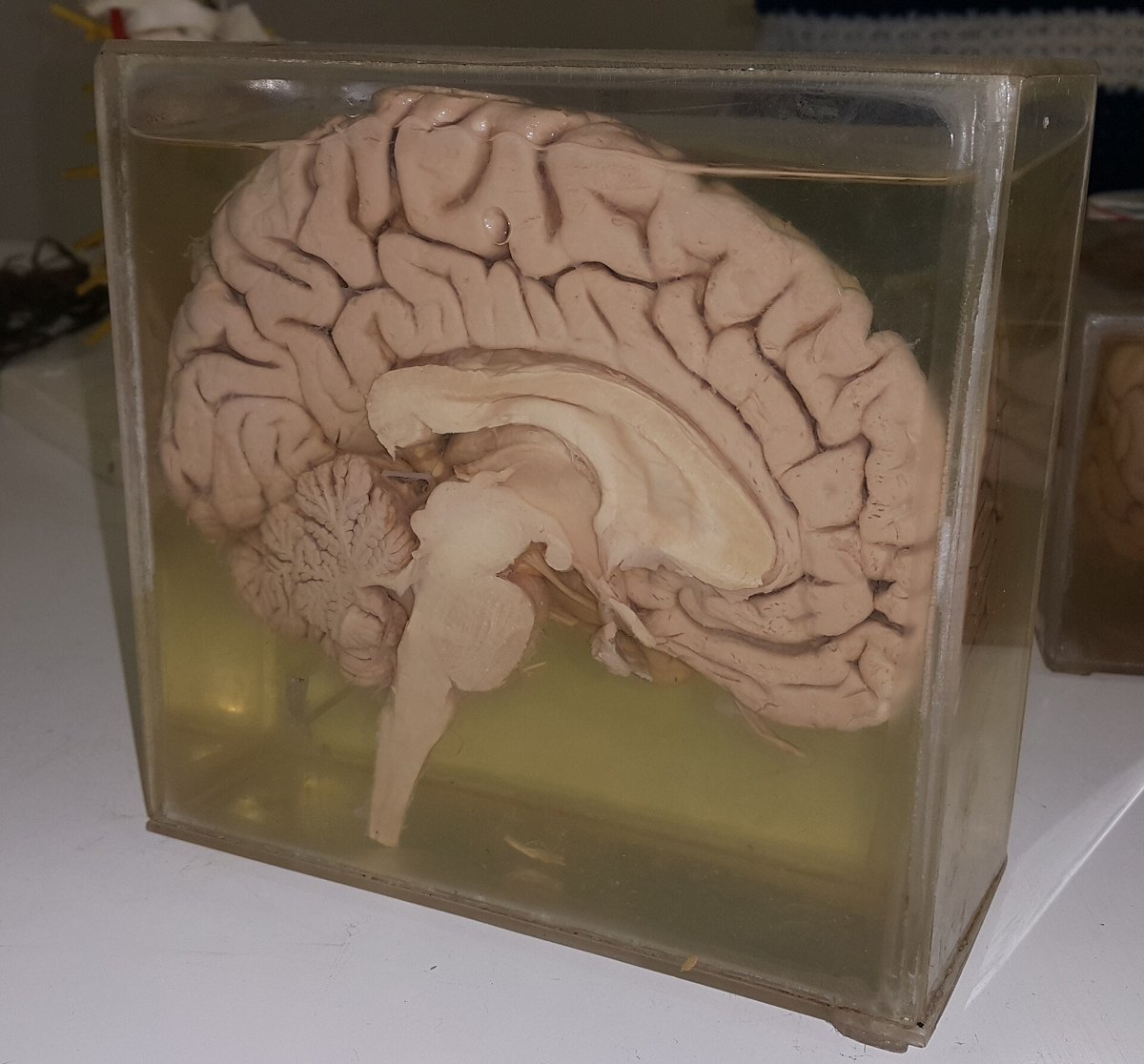 Sagittal section of a human brain specimen