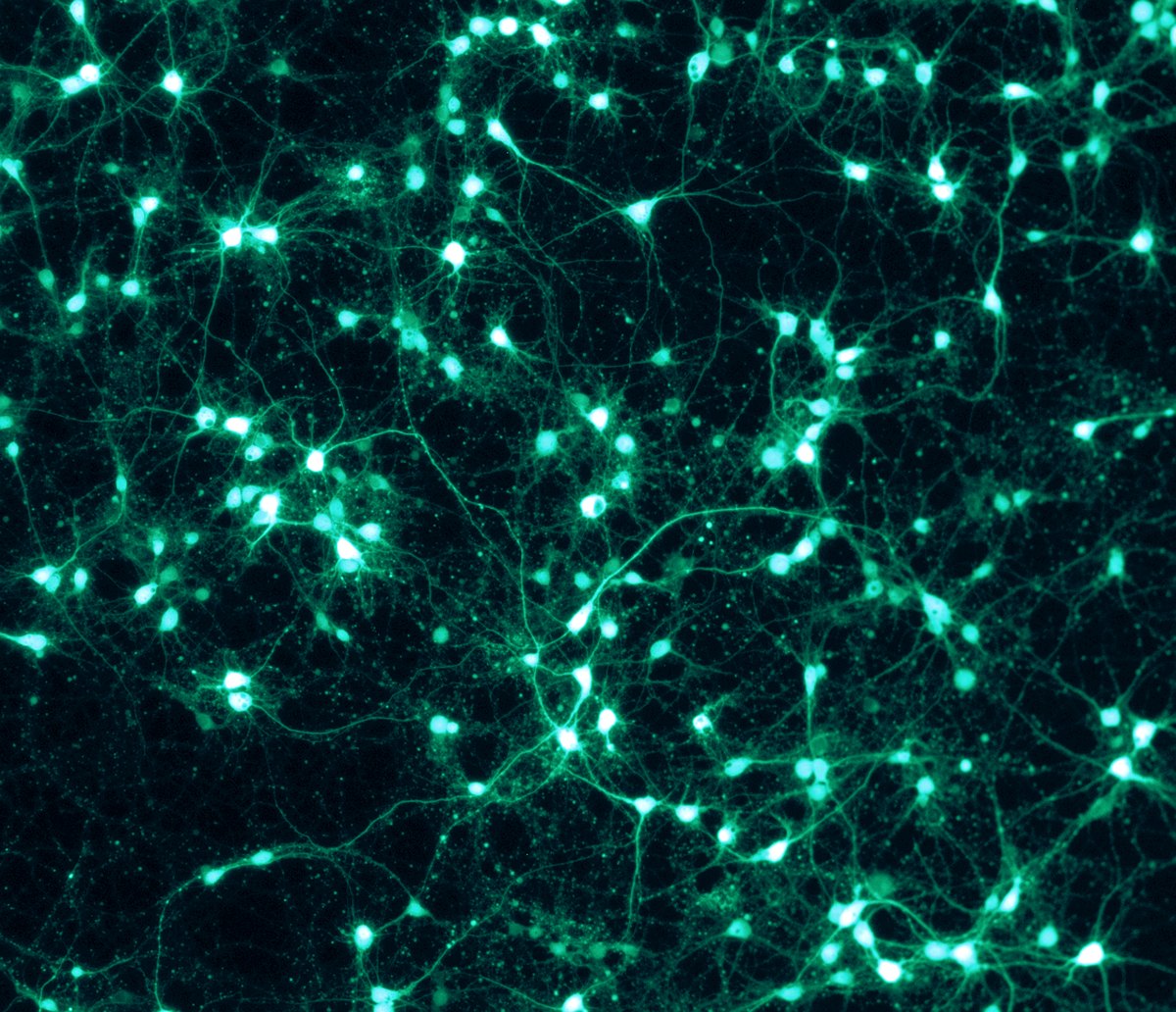 Fluorescent-labeled neurons in culture