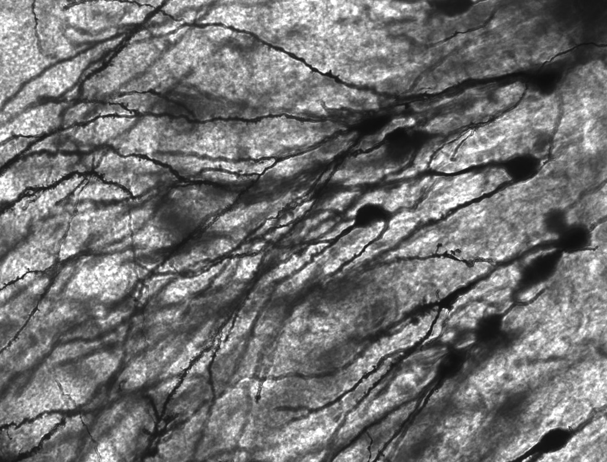 Micrograph of pyramidal neurons using a Golgi stain
